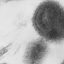 천연두 바이러스 비알이 발견된 미국 펜실베이니아 실험실